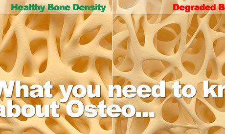 Osteoporosis Bone Density