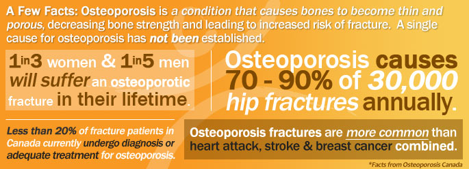 osteoporosis facts